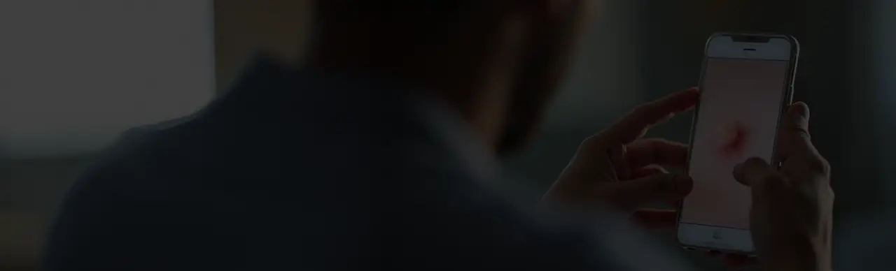 Revamping an AI-based skin cancer detection app for a Dutch healthtech firm